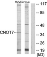 Western blot of extracts from HeLa/HUVEC cells, using CNOT7 Antibody. The lane on the right is treated with the synthesized peptide.