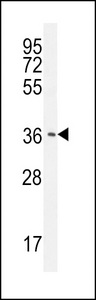 CAF-1 Antibody western blot of HepG2 cell line lysates (35 ug/lane). The CAF-1 antibody detected the CAF-1 protein (arrow).