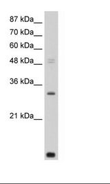 HepG2 Cell Lysate