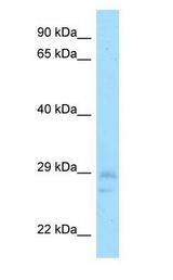 HCAF1 / CNOT8 antibody Western Blot of Mouse Testis.