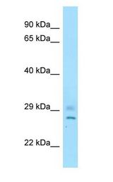 HCAF1 / CNOT8 antibody Western Blot of Mouse Testis.