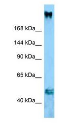 COL11A1 / Collagen XI antibody Western Blot of Mouse Pancreas.