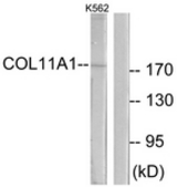 Western blot of extracts from K562 cells, using Collagen XI alpha1 Antibody. The lane on the right is treated with the synthesized peptide.