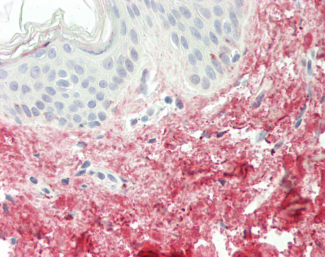 Human Skin: Formalin-Fixed, Paraffin-Embedded (FFPE)