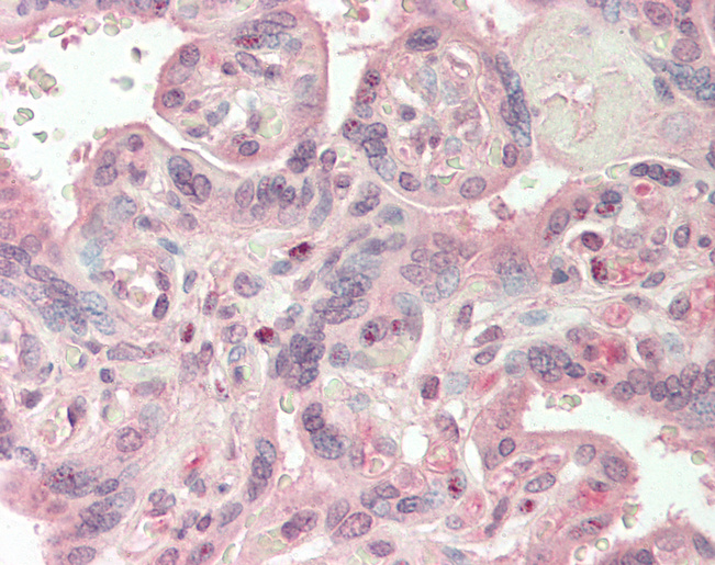 Human Placenta: Formalin-Fixed, Paraffin-Embedded (FFPE)