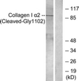 Western blot of extracts from Jurkat cells, treated with etoposide 25 uM 24h, using Collagen I alpha2 (Cleaved-Gly1102) Antibody. The lane on the right is treated with the synthesized peptide.