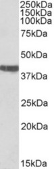 TNNT2 antibody (0.03 ug/ml) staining of Rat Heart lysate (35 ug protein in RIPA buffer). Primary incubation was 1 hour. Detected by chemiluminescence.