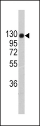 Western blot of anti-COL2A1 Antibody (RB13830) in 293 cell line lysates (35 ug/lane). COL2A1(arrow) was detected using the purified antibody.