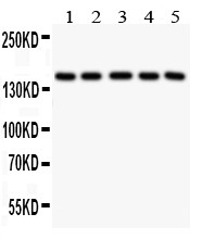 COL4A1 antibody Western blot. All lanes: Anti COL4A1 at 0.5 ug/ml. Lane 1: MM231 Whole Cell Lysate at 40 ug. Lane 2: HELA Whole Cell Lysate at 40 ug. Lane 3: JURKAT Whole Cell Lysate at 40 ug. Lane 4: SW620Whole Cell Lysate at 40 ug. Lane 5: A549 Whole Cell Lysate at 40 ug. Predicted band size: 160 kD. Observed band size: 160 kD.