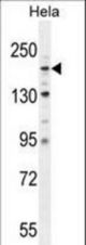 COL4A2 Antibody western blot of HeLa cell line lysates (35 ug/lane). The COL4A2 antibody detected the COL4A2 protein (arrow).