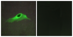 Immunofluorescence of HeLa cells, using Collagen IV alpha5 Antibody. The picture on the right is treated with the synthesized peptide.