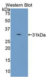 Western blot of recombinant COL4A5 / Collagen IV.