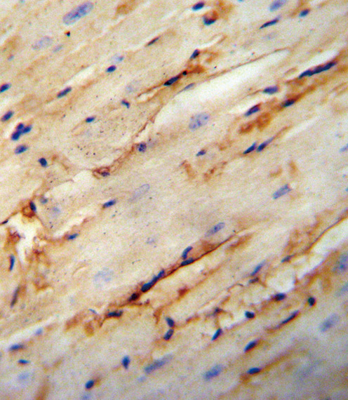 COL5A1 antibody immunohistochemistry of formalin-fixed and paraffin-embedded mouse heart tissue followed by peroxidase-conjugated secondary antibody and DAB staining.