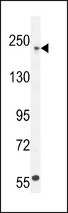 COL5A1 Antibody western blot of U251 cell line lysates (35 ug/lane). The COL5A1 antibody detected the COL5A1 protein (arrow).