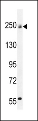 COL5A1 Antibody western blot of mouse bladder tissue lysates (35 ug/lane). The COL5A1 antibody detected the COL5A1 protein (arrow).