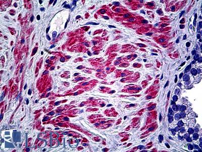 Anti-COL5A2 antibody IHC of human prostate. Immunohistochemistry of formalin-fixed, paraffin-embedded tissue after heat-induced antigen retrieval. Antibody LS-B5364 concentration 10 ug/ml.