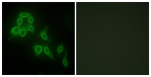 Immunofluorescence of HepG2 cells, using Collagen V alpha2 Antibody. The picture on the right is treated with the synthesized peptide.