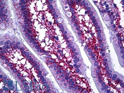 Anti-COL6A1 antibody IHC of human intestine. Immunohistochemistry of formalin-fixed, paraffin-embedded tissue after heat-induced antigen retrieval. Antibody LS-B5685 concentration 10 ug/ml.