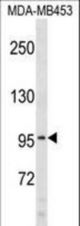 COL6A2 Antibody western blot of MDA-MB453 cell line lysates (35 ug/lane). The COL6A2 antibody detected the COL6A2 protein (arrow).