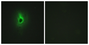 Immunofluorescence of HeLa cells, using Collagen VI alpha3 Antibody. The picture on the right is treated with the synthesized peptide.