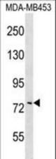COL8A1 Antibody western blot of MDA-MB453 cell line lysates (35 ug/lane). The COL8A1 antibody detected the COL8A1 protein (arrow).