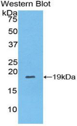 Western blot of recombinant COL8A1 / Collagen VIII.