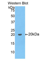 Western blot of recombinant COL8A1 / Collagen VIII.