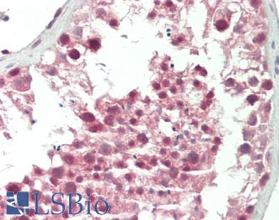 Human Testis: Formalin-Fixed, Paraffin-Embedded (FFPE)