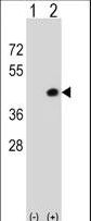 Western blot of Dapk2 (arrow) using rabbit polyclonal Mouse Dapk2 Antibody. 293 cell lysates (2 ug/lane) either nontransfected (Lane 1) or transiently transfected (Lane 2) with the Dapk2 gene.