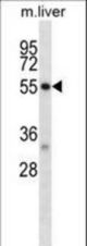 Mouse Dapk2 Antibody western blot of mouse liver tissue lysates (35 ug/lane). The Dapk2 antibody detected the Dapk2 protein (arrow).