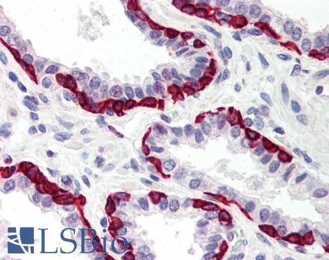 Anti-DAPK2 antibody IHC of human prostate. Immunohistochemistry of formalin-fixed, paraffin-embedded tissue after heat-induced antigen retrieval. Antibody LS-B556 concentration 5 ug/ml.