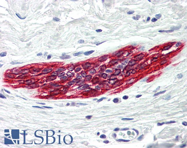 Anti-DAPK2 antibody IHC of human breast. Immunohistochemistry of formalin-fixed, paraffin-embedded tissue after heat-induced antigen retrieval. Antibody LS-B556 concentration 5 ug/ml.