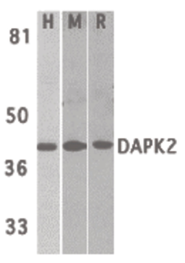 Western blot of DAPK2 in A431 (H), mouse spleen (M), and rat kidney (R) lysates with DAPK2 antibody at 1 ug/ml.