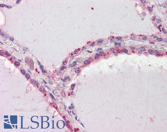 Anti-DAPK2 antibody IHC of human thyroid. Immunohistochemistry of formalin-fixed, paraffin-embedded tissue after heat-induced antigen retrieval. Antibody LS-B3593 concentration 2.5 ug/ml.