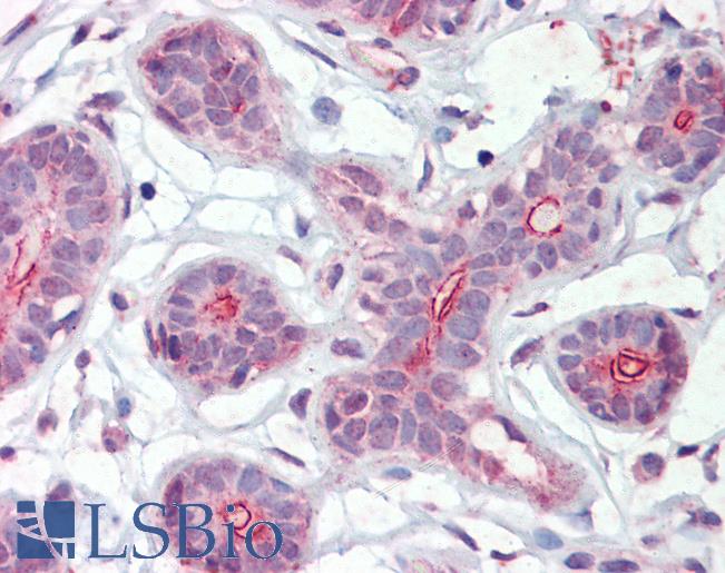 Anti-DAPK2 antibody IHC of human breast. Immunohistochemistry of formalin-fixed, paraffin-embedded tissue after heat-induced antigen retrieval. Antibody LS-B3593 concentration 2.5 ug/ml.