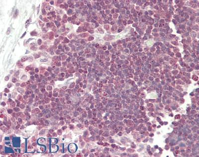Human Thymus: Formalin-Fixed, Paraffin-Embedded (FFPE)