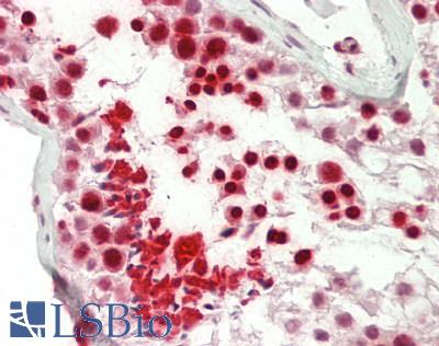Human Testis: Formalin-Fixed, Paraffin-Embedded (FFPE)