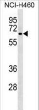 DCT Antibody western blot of NCI-H460 cell line lysates (35 ug/lane). The DCT antibody detected the DCT protein (arrow).