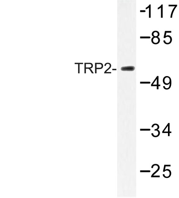 Western blot of TRP2 (K89) pAb in extracts from K562 cells.