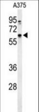 Western blot of DCT Antibody in A375 cell line lysates (35 ug/lane). DCT (arrow) was detected using the purified antibody.