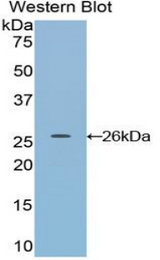 Western blot of recombinant DDAH / DDAH1.