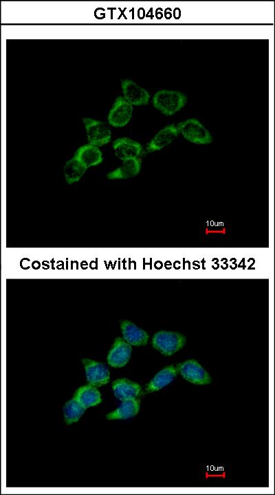 Immunofluorescence of methanol-fixed HCT116 using DDAH1 antibody at 1:500 dilution.