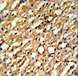 Formalin-fixed and paraffin-embedded mouse kidney reacted with DDAH1 Antibody , which was peroxidase-conjugated to the secondary antibody, followed by DAB staining. This data demonstrates the use of this antibody for immunohistochemistry; clinical relevance has not been evaluated.