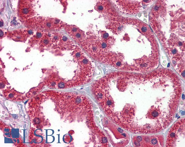 Anti-DDAH1 antibody IHC of human kidney. Immunohistochemistry of formalin-fixed, paraffin-embedded tissue after heat-induced antigen retrieval. Antibody LS-B5857 concentration 2.5 ug/ml.