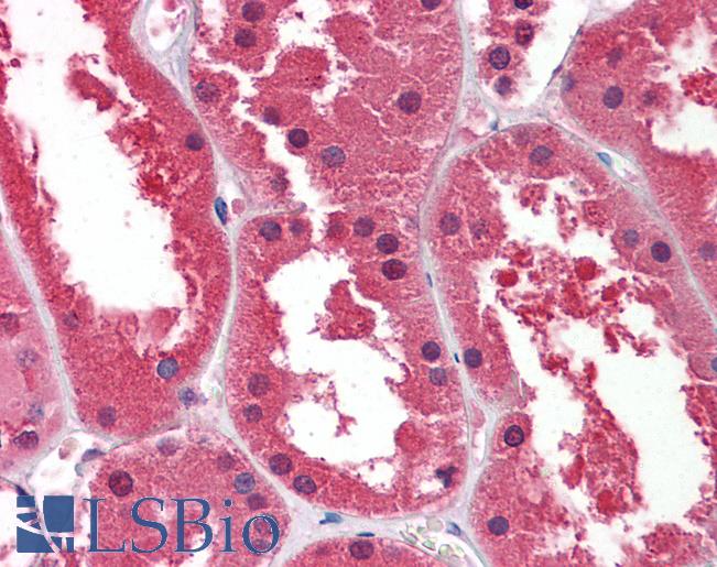 Anti-DDAH1 antibody IHC of human kidney. Immunohistochemistry of formalin-fixed, paraffin-embedded tissue after heat-induced antigen retrieval. Antibody LS-B5858 concentration 2.5 ug/ml.