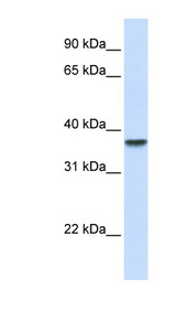 DDAH1 antibody LS-B5858 Western blot of Fetal Liver lysate.