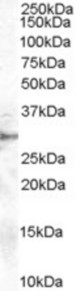 Antibody staining (1 ug/ml) of human heart extracts (RIPA buffer, 35 ug total protein per lane). Primary incubated for 1 hour. Detected by Western blot of chemiluminescence.