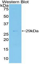 Western blot of recombinant DDAH2 / DDAH.