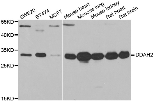 Western blot analysis of extracts of various cell lines, using DDAH2 antibody.