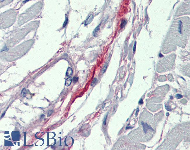 Anti-DDAH2 antibody IHC of human heart. Immunohistochemistry of formalin-fixed, paraffin-embedded tissue after heat-induced antigen retrieval. Antibody LS-B4001 concentration 5 ug/ml.